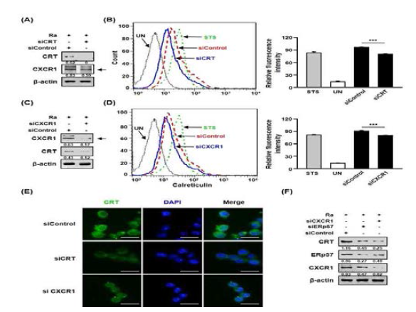 결핵균 감염 시 CXCR1의 발현이 샤페론 단백질 CRT 세포 내 위치이동에 미치는 영향