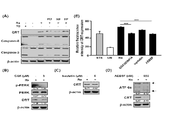 결핵균 감염 시 MAPK pathway와 ER stress가 샤페론 단백질 CRT의 발현에 미치는 영향