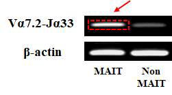 분리된 MAIT세포에서 RT-PCR