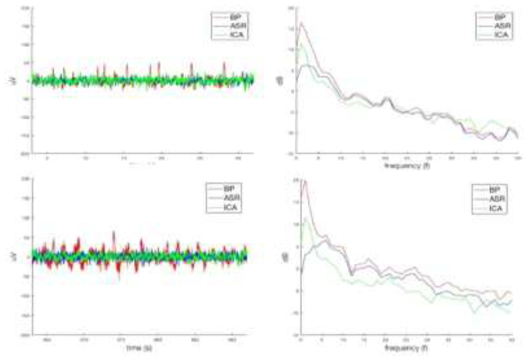 EEG의 노이즈 제거를 위한 기술 개발