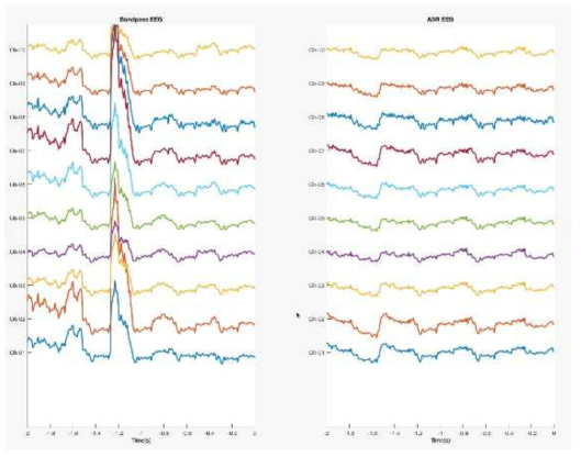 Bandpass filter를 적용한 EEG(좌) 와 ASR을 적용한 EEG(우) 비교