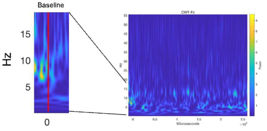 Continuous Wavelet Transform을 이용하여 개인화 지표의 주파수 대역 검증