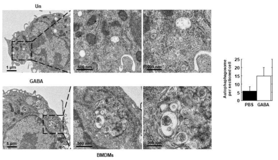 공생미생물 유래 염증제어인자인 GABA에 의한 마우스 골수 대식세포 내 자가포식낭의 증가