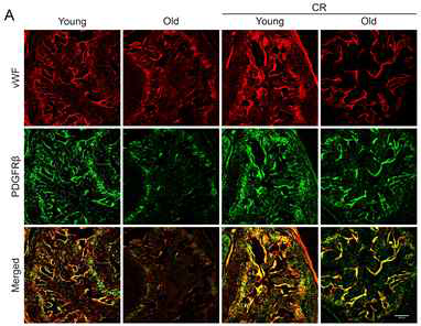 Calorie restriction (CR) increases cavernous pericyte content