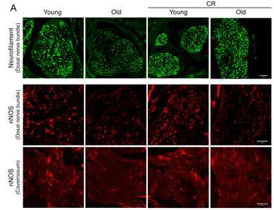 Calorie restriction (CR) promotes neural regeneration