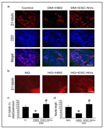 Embryonic stem cell (ESC)-derived extracellular vesicle- mimetic nanovesicles (ESC-NVs) induce neural regeneration under diabetic conditions