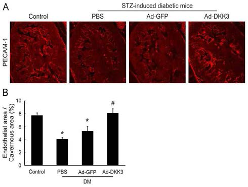Adenoviral DKK3 gene transfer increases cavernous endothelial content