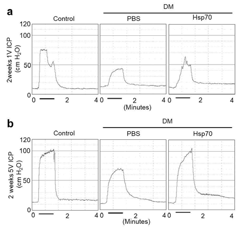 Hsp70 restores erectile function in diabetic mice