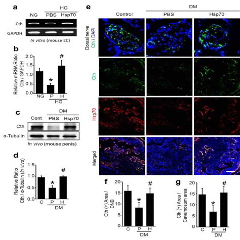 Hsp70 regulates the expression of cystathionine gamma-lyase (Cth) under diabetic conditions