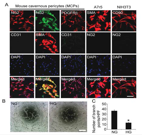 Impaired tube formation in mouse cavernous pericytes (MCPs) exposed to high-glucose condition