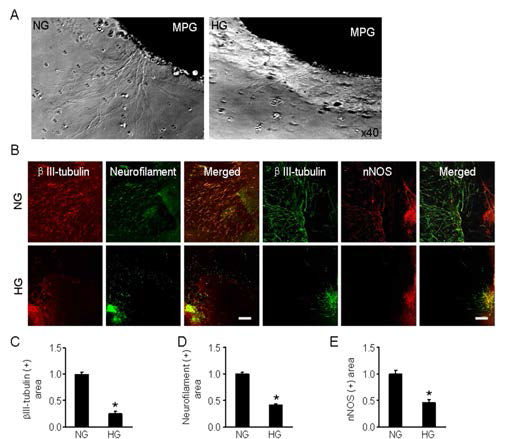 Impaired neurite sprouting in major pelvic ganglion (MPG) tissue exposed to high-glucose condition