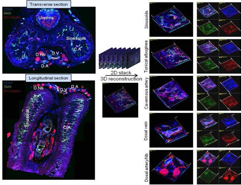 The principle of three-dimensional reconstruction of penile neurovascular system