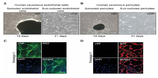 Isolation and characterization of human cavernous endothelial cells and pericytes