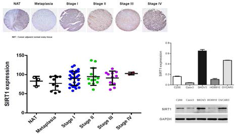 난소암 조직에서 SIRT1의 발현연구