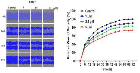 Selective SIRT1 inhibitor의 처리에 의한 암세포의 migration에 미치는 영향