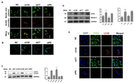 siPKM2처리에 의해 autophagy cell death pathway에 미치는 영향 연구