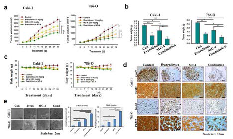 In vivo xenograft model에서 PKM2 및 mTOR dual inhibitor에 의한 암세포 사멸 기전 규명