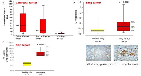 다양한 종류의 암환자 조직에서 PKM2의 발현에 패턴 분석