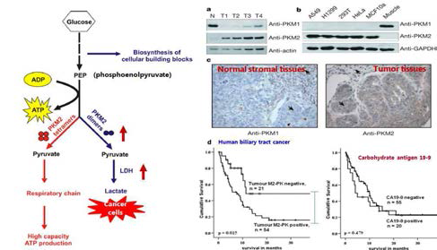 암환자의 조직에서 PKM2의 과발현 및 survival rate에 미치는 영향