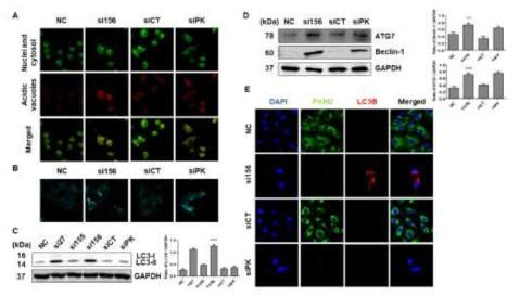 Evaluation of induction of autophagy after PKM2 expression knockdown