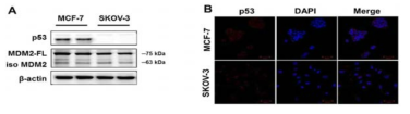 MCF-7과 SK-OV-3 cells에서 SIRTs, p53의 발현 패턴 비교