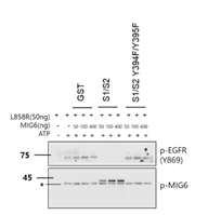 GST 융합 Mig6 S1&2 단백질을 이용한 in-vitro kinase assay