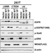 EGFR 돌연변이와 MIG6를 동시 과발현시킨 293T 세포주에서의 EGFR 발현 및 인산화 정도