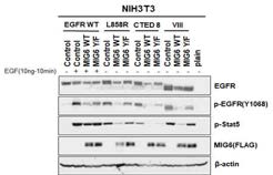 EGFR 돌연변이와 MIG6를 동시 과발현시킨 NIH3T3 세포주에서의 EGFR 발현 및 인산화 정도
