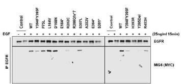 293T 세포에서 MIG6 돌연변이와 EGFR 사이의 결합여부 확인
