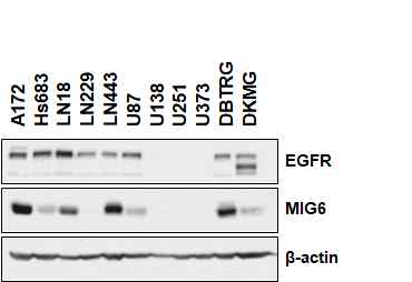 뇌종양 세포주에서 확인한 EGFR과 MIG6의 발현량 비교