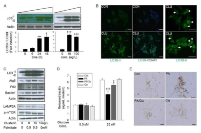 Autophagy activation and improvement on viability and insulin secretion by clusterin treatment in glucotoxicity-induced pancreatic beta cells