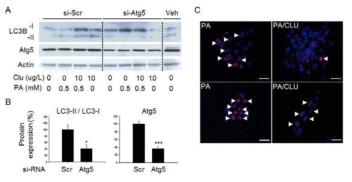 Mediation of autophagy in clusterin-induced beta cell protection