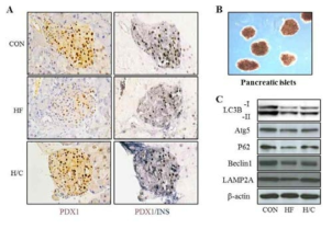 Protective effect of clusterin in beta-cells against high fat diet-induced toxicity