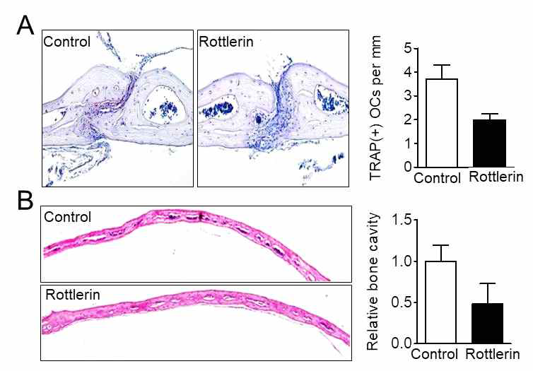 PKCδ의 저해약물인 rottlerin에 의한 파골세포의 형성과 골 흡수 저해. 생쥐의 calvarial periosteum에 rottlerin (2 mg/kg)를 5일 동안 매일 처리 후 골 지표를 분석함