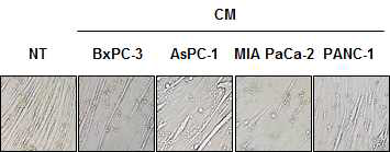 췌장암 세포의 CM에 의한 근육세포에서 근위축 모델 확립