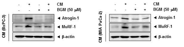췌장암세포 CM에 의한 근육단백질 분해 인자들 발현에 대한 BGM의 효과