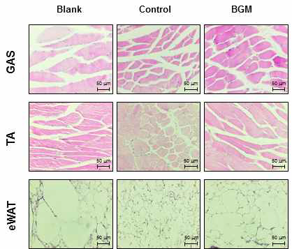 암성 악액질 동물모델에서 BGM 투여에 의한 근육과 지방조직의 H&E 염색