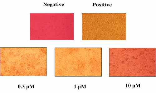 In vitro system에서 비만 세포 억제에 관여하는 추출물의 영향