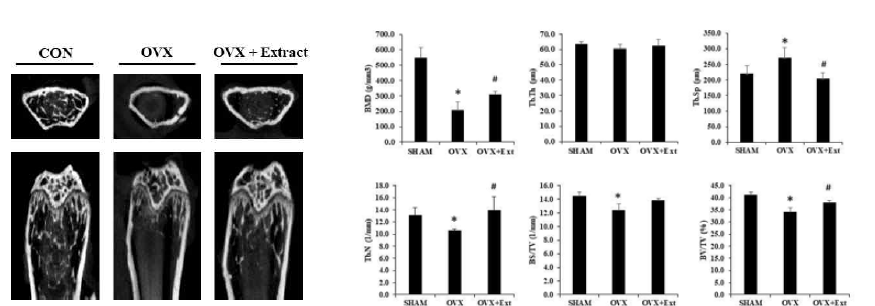난소를 제거 (OVX)한 마우스에 추출물을 처리한 후 대퇴골의 micro CT를 촬영한 결과
