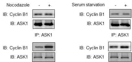 세포주기 arrest에 의한 cyclin B1, ASK1의 발현 변화 및 세포 내 결합 변화