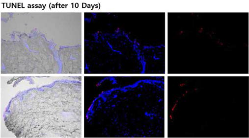 나노선 소자에 침습된 피부 조직의 10일 간 세포 배양 후 TUNEL assay 이미지