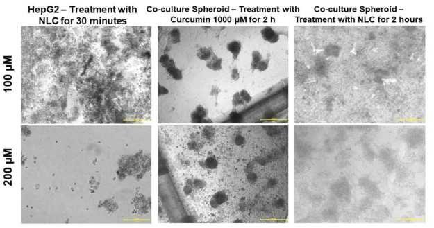 NLC-curcumin 처리 시 공배양 세포칩에서의 광학 이미지