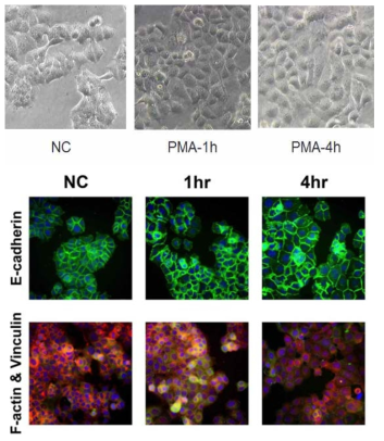 PMA처리 시간에 따른 세포 변화