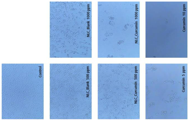 NLC 처리에 따른 C6 glioma cell의 morphology 변화