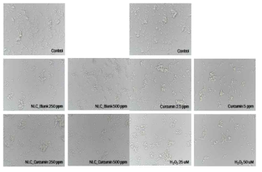 NLC 처리에 따른 SH-SY5Y cell의 morphology 변화(6시간)