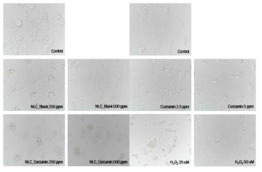 NLC 처리에 따른 SH-SY5Y cell의 morphology 변화(12시간)