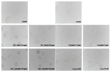 NLC 처리에 따른 SH-SY5Y cell의 morphology 변화(24시간)