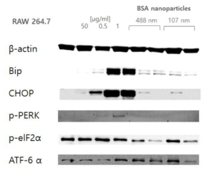 western blot을 이용한 ER stress관련 단백질 발현 확인
