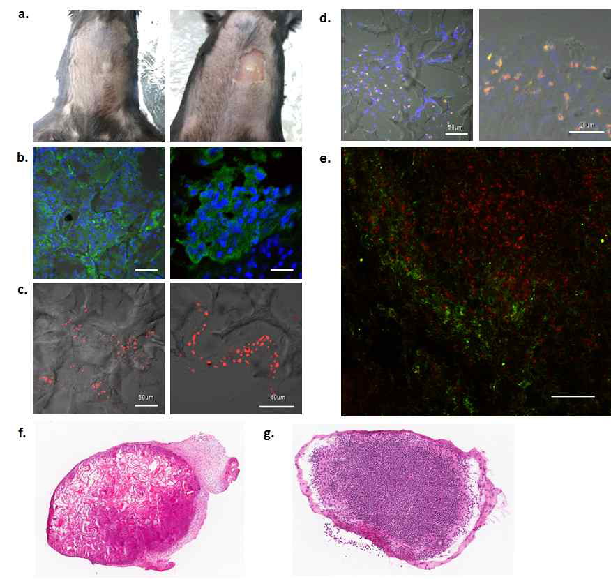 4~5주 후 SVF와 DC를 함께 이식한 실험군의 생쥐를 면역조직화학법(immunohistochemistry)으로 염색하였음 a. 콜라겐 스폰지 복합체 삽입 4주 후 사진, b. T 세포 확인(CD3, 녹색), 핵(파란색), 흰색바=50μm, c. B 세포 확인(B220, 붉은색), d. 수지상세포 확인 (CD11b(붉은색), CD11c(녹색)), 핵(파란색), e. T 세포(CD3, 녹색)와 B 세포(B220, 붉은색)가 군집을 이루고 있는 모양. 흰색 바=50μm. f. H&E 염색함 (SVF를 탑재한 콜라겐 스폰지) g. 림프절을 H&E 염색함