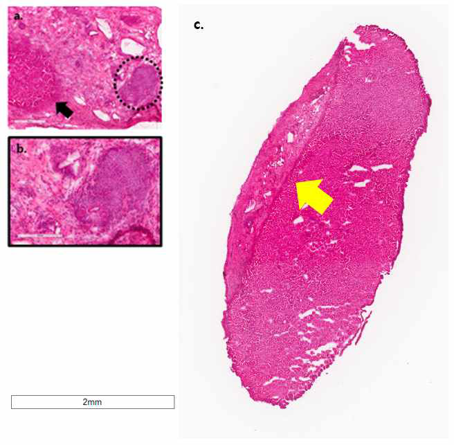 a. 삽입체를 H&E 염색한 모습. 검은색 화살표 : 신장구조, 점선 : 삽입체에 생긴 구조 b. 그림.a의 점선 부분을 확대한 사진, c. H&E 염색한 삽입체와 신장. 노란색 화살표가 가리키는 삽입체와 신장 구조를 구분하는 선을 기준으로 왼쪽 부분이 삽입체